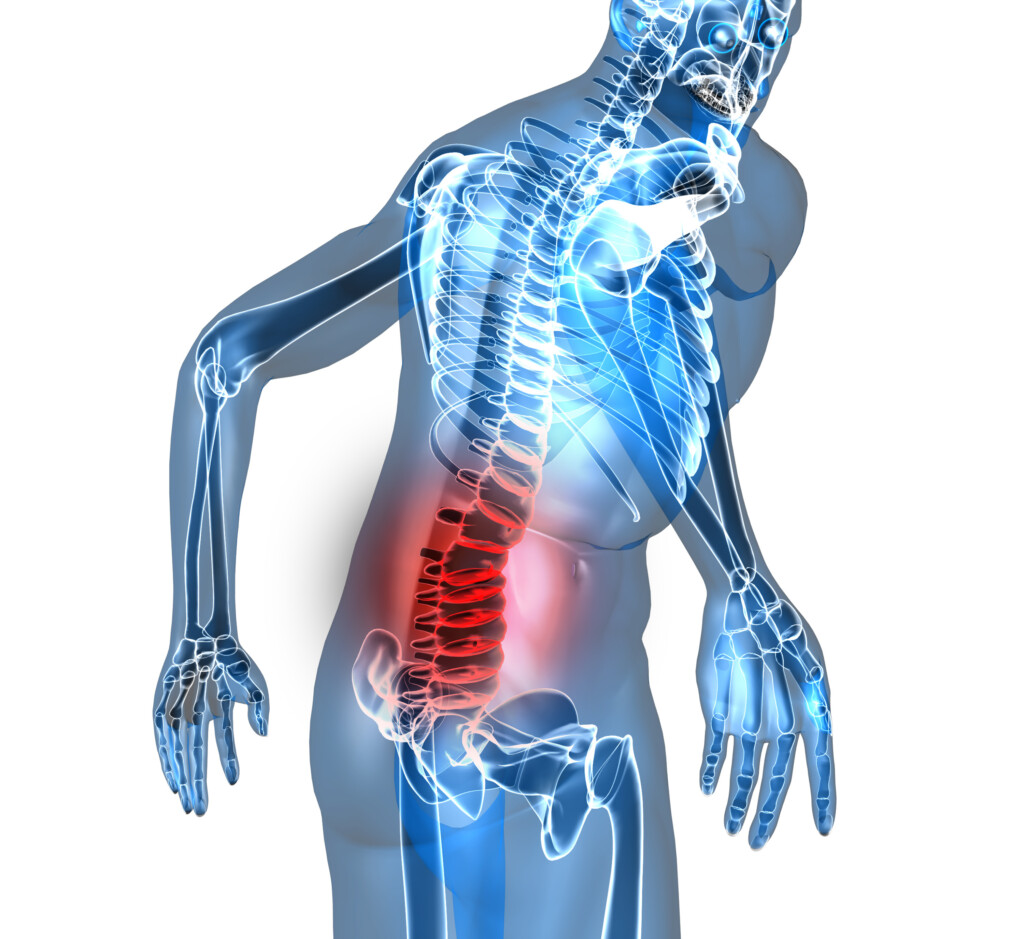 5 Common Causes Of Low Back Pain