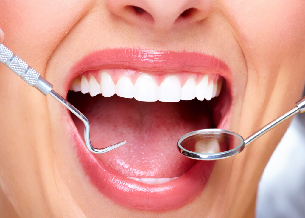 Cedar Smile Family Dentistry Dentistry Dental Smile Fillings Brampton 