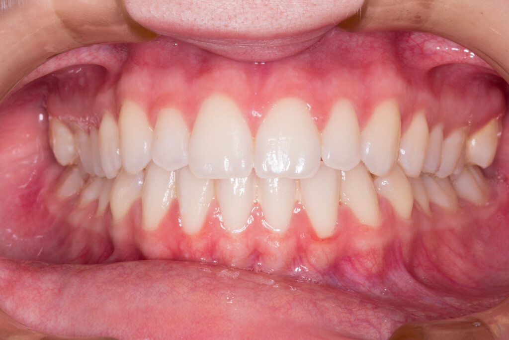 Four Different Types Of Teeth And Their Function Shervin M Louie DDS