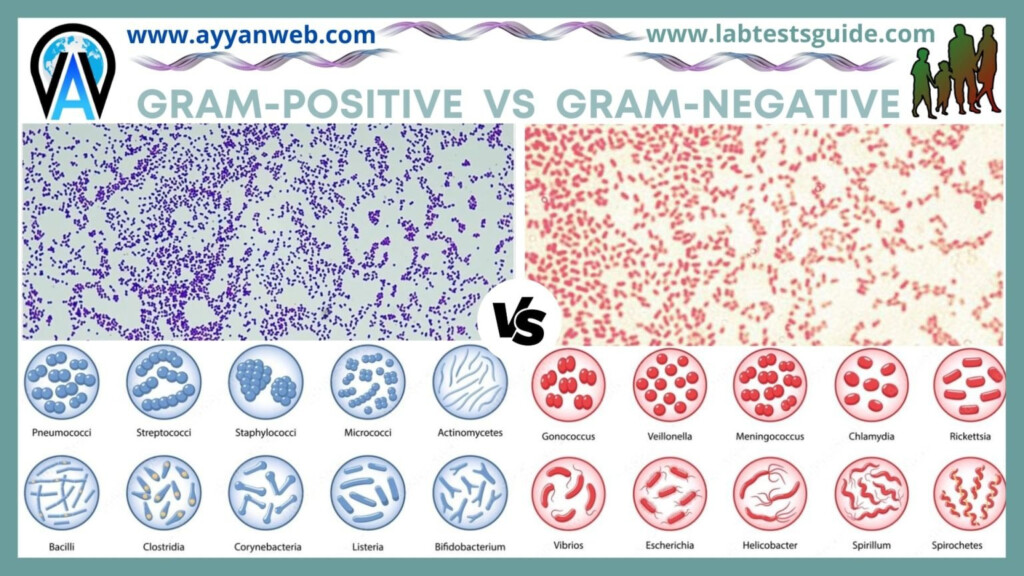 Gram Positive VS Gram Negative Bacteria Lab Tests Guide