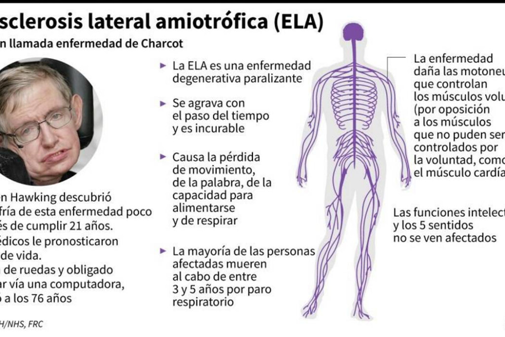 La Esclerosis Lateral Amiotr fica Una Enfermedad Neurodegenerativa 