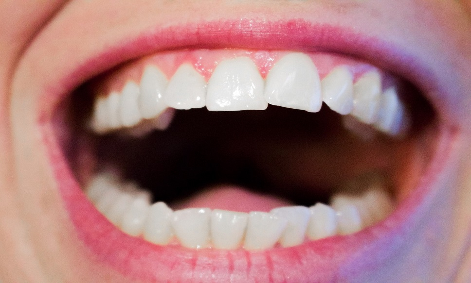 Looking For Overall Health Take Care Of Your Oral Health A World Oral 
