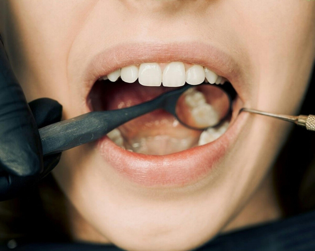 PhilHealth To Cover Preventive Oral Health Services